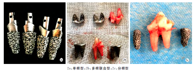 3D打印多孔钛个性化根形种植体的体内骨愈合研究