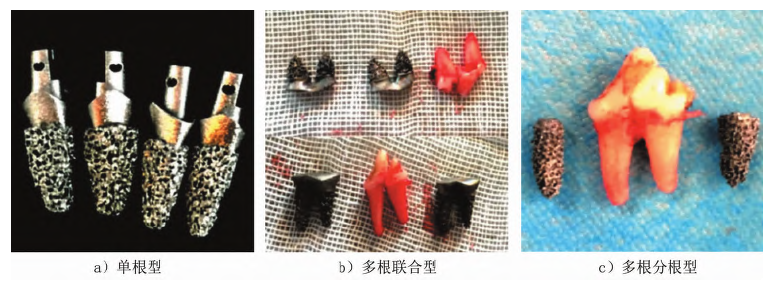 增材制造医用多孔钛合金研究与应用现状
