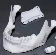 生物陶瓷材料的3D打印技术现状
