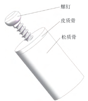 基于有限元分析的钛合金椎弓根螺钉螺纹结构优化