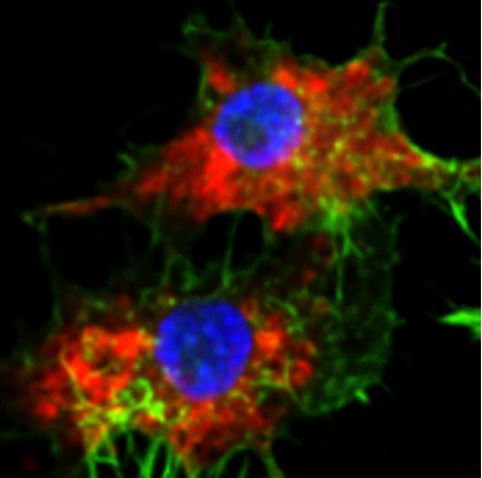 动物试验中化疗药效提高两万倍，纳米新技术有效清除白血病细胞