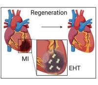 干细胞贴片无需大手术修复心脏，为心衰治疗开辟新路径