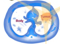 电离辐射诱导药物的释放或激活