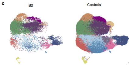 全球第7例！干细胞移植缓解艾滋病患者症状