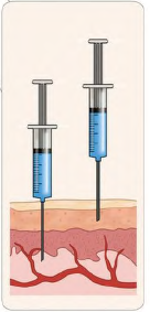 用于癌症治疗的mRNA疫苗递送策略