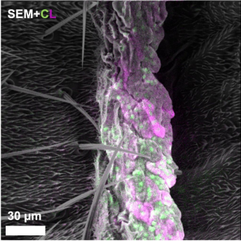 兼具电子显微镜与荧光显微镜双重优势，新成像技术能同步观测细胞精细结构