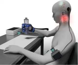 全球首个植入式脑机接口三类医疗器械获批上市