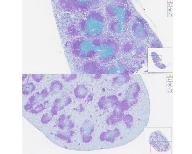 纳米颗粒在人体内&ldquo;教导&rdquo;T细胞精准&ldquo;杀敌&rdquo;