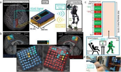 迈向全植入式系统重要一步&mdash;&mdash;双向脑机接口同步恢复患者行走与感觉